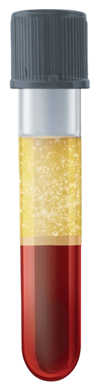 A glass collection tube with red-colored liquid inside, topped with a black cap.